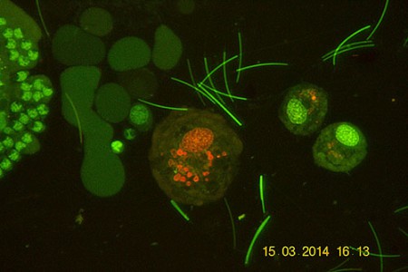 Spermatogonio di lombricus 